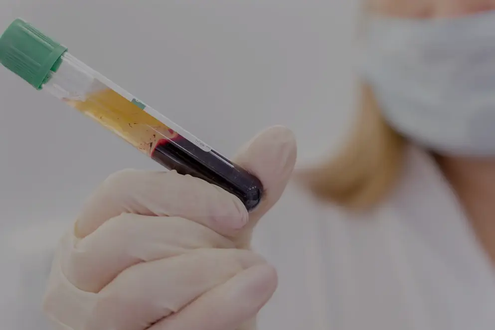 Doctor separates blood and plasma