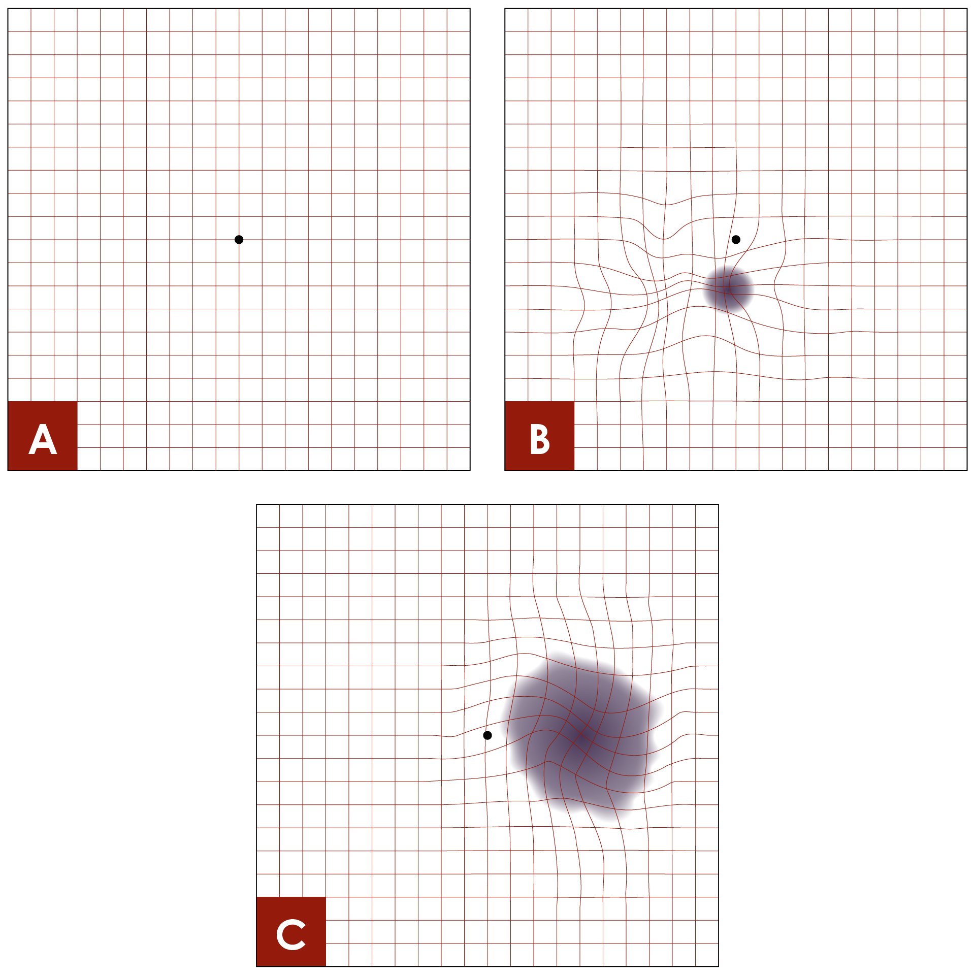 Examples of the Amsler grid, when viewed by people with varying functional vision