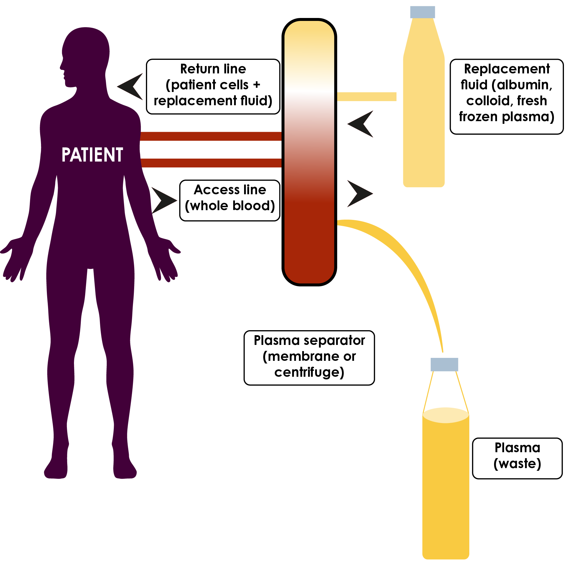 The role of albumin in therapeutic plasma exchange